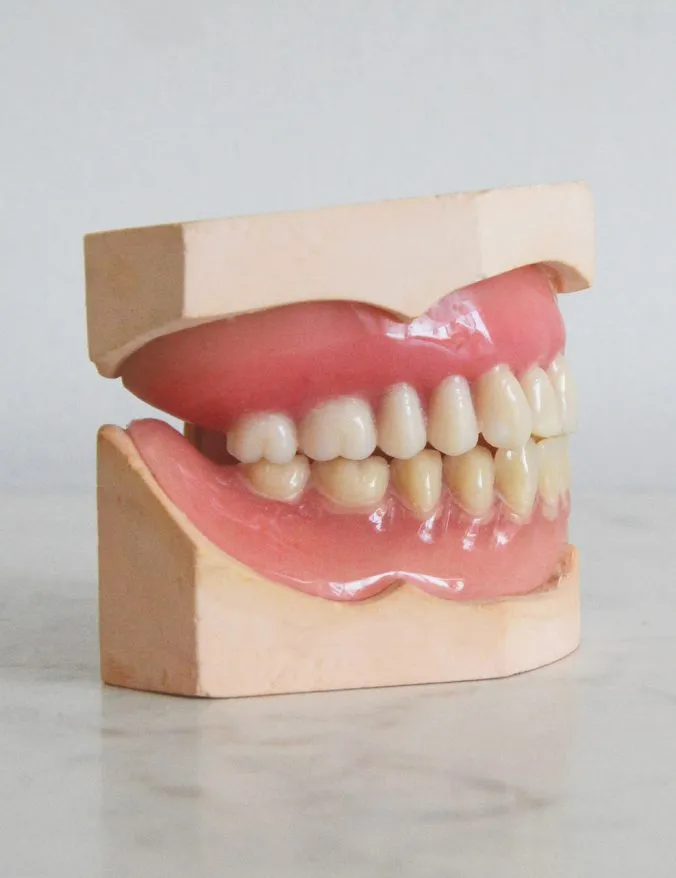 Dente e prótese dentária